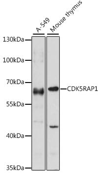 Western blot analysis of extracts of various cell lines, using Anti-CDK5RAP1 Antibody (A15844) at 1:1,000 dilution.
Secondary antibody: Goat Anti-Rabbit IgG (H+L) (HRP) (AS014) at 1:10,000 dilution.
Lysates / proteins: 25µg per lane.
Blocking buffer: 3% non-fat dry milk in TBST.
Detection: ECL Enhanced Kit (RM00021).
Exposure time: 30s.