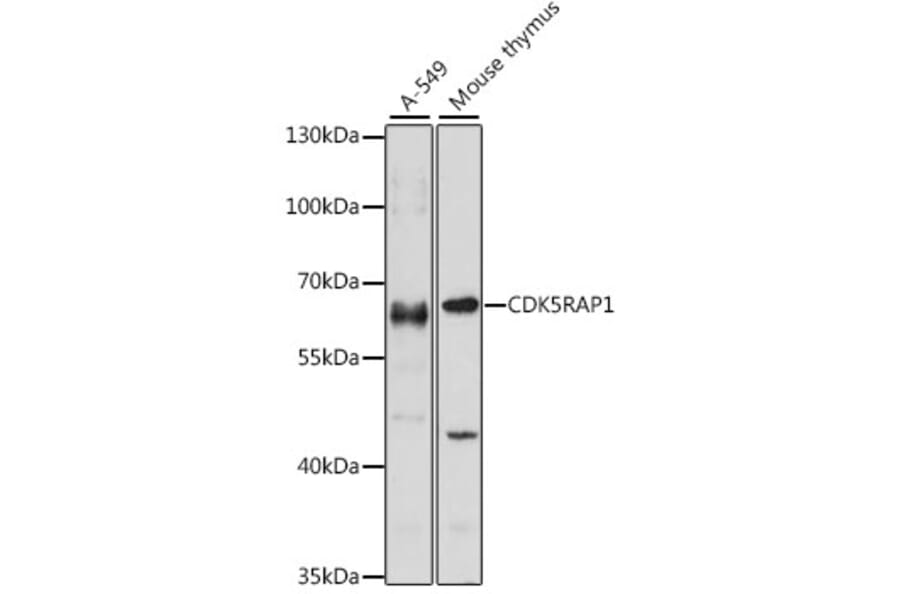 Western Blot - Anti-CDK5RAP1 Antibody (A90897) - Antibodies.com