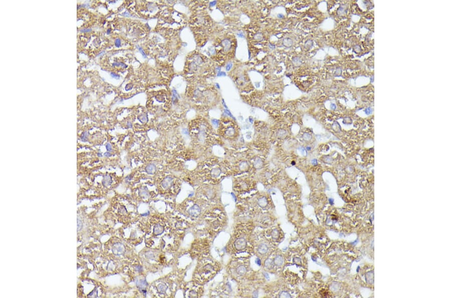 Immunohistochemistry - Anti-CDK5RAP1 Antibody (A90897) - Antibodies.com