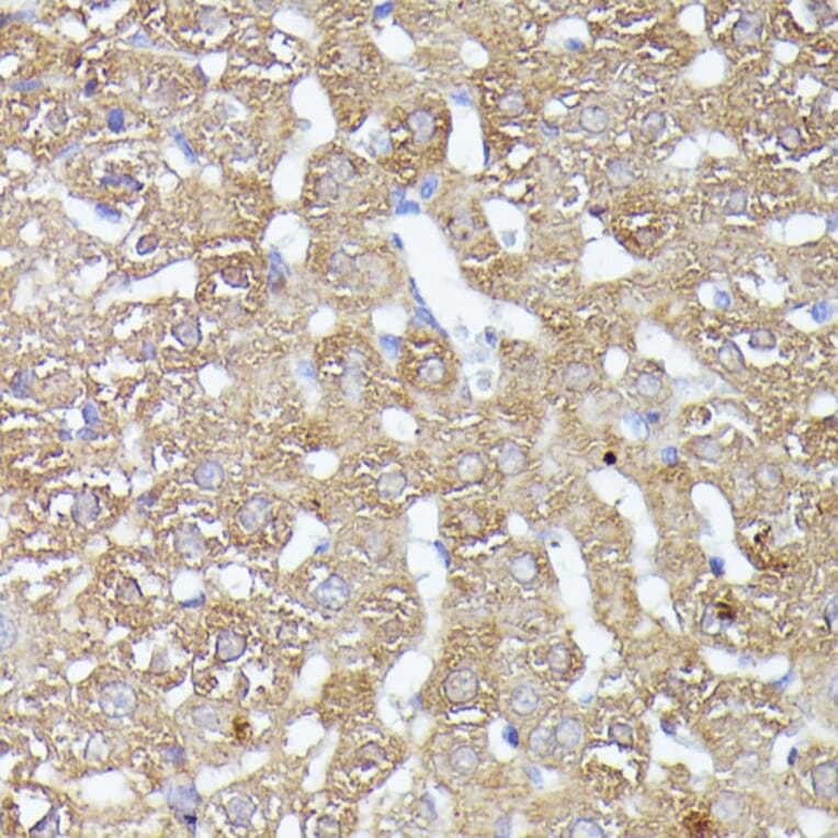 Immunohistochemistry - Anti-CDK5RAP1 Antibody (A90897) - Antibodies.com