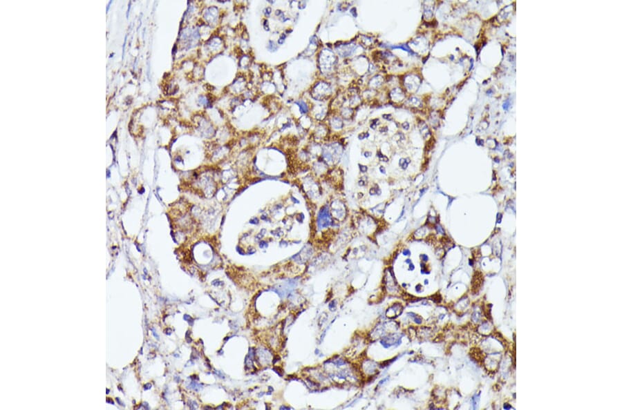 Immunohistochemistry - Anti-CDK5RAP1 Antibody (A90897) - Antibodies.com
