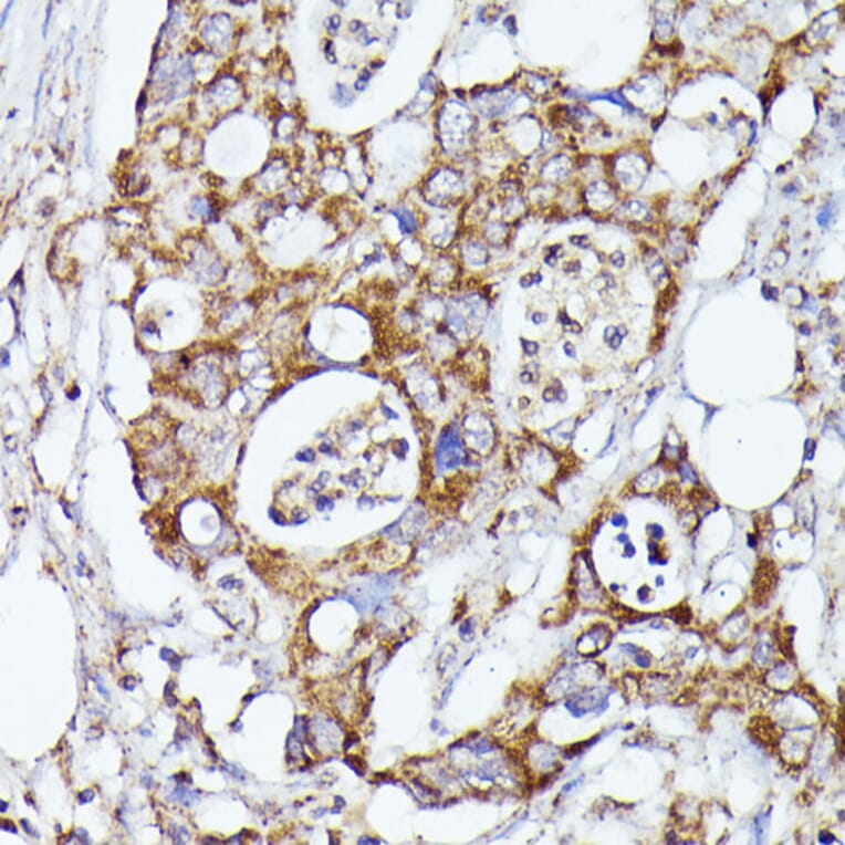 Immunohistochemistry - Anti-CDK5RAP1 Antibody (A90897) - Antibodies.com