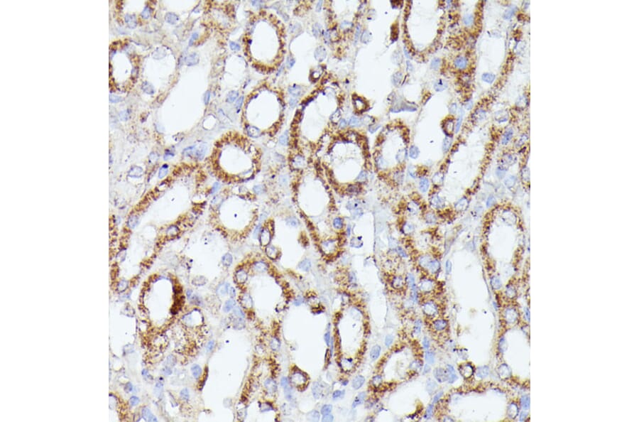 Immunohistochemistry - Anti-CDK5RAP1 Antibody (A90897) - Antibodies.com