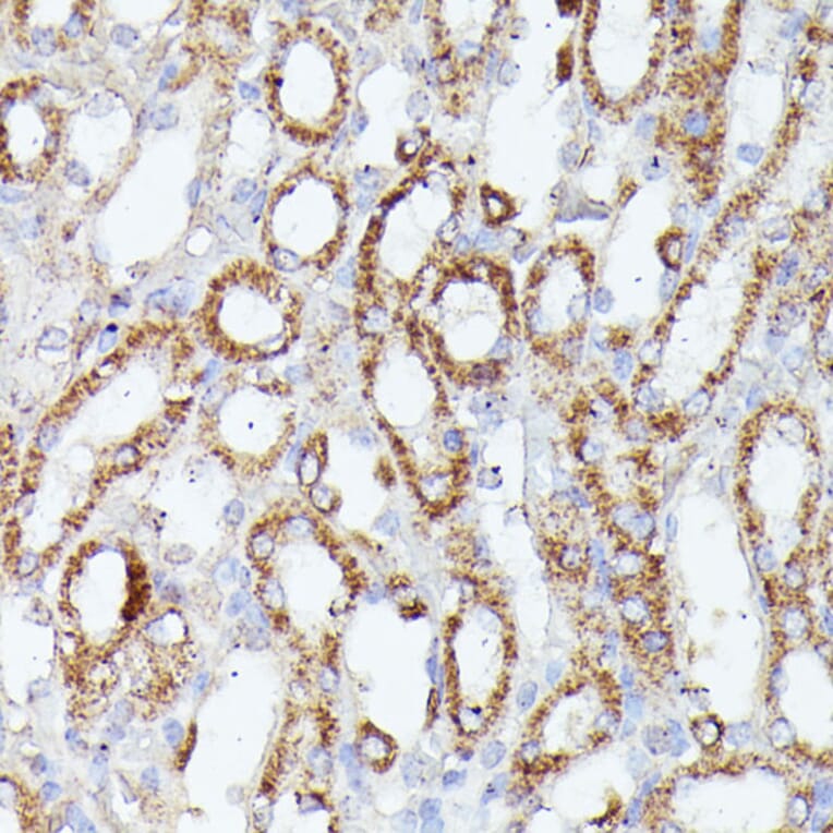 Immunohistochemistry - Anti-CDK5RAP1 Antibody (A90897) - Antibodies.com