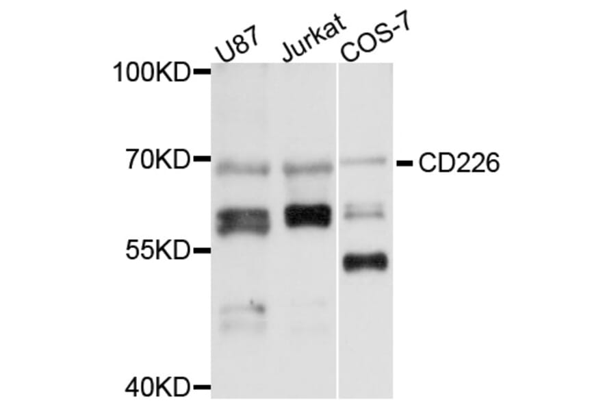 Western Blot - Anti-CD226 Antibody (A13398) - Antibodies.com