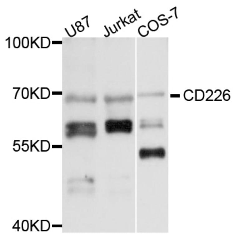 Western Blot - Anti-CD226 Antibody (A13398) - Antibodies.com