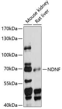 Western blot analysis of extracts of various cell lines, using Anti-NDNF Antibody (A14930) at 1:1,000 dilution.
Secondary antibody: Goat Anti-Rabbit IgG (H+L) (HRP) (AS014) at 1:10,000 dilution.
Lysates / proteins: 25µg per lane.
Blocking buffer: 3% non-fat dry milk in TBST.
Detection: ECL Basic Kit (RM00020).
Exposure time: 30s.