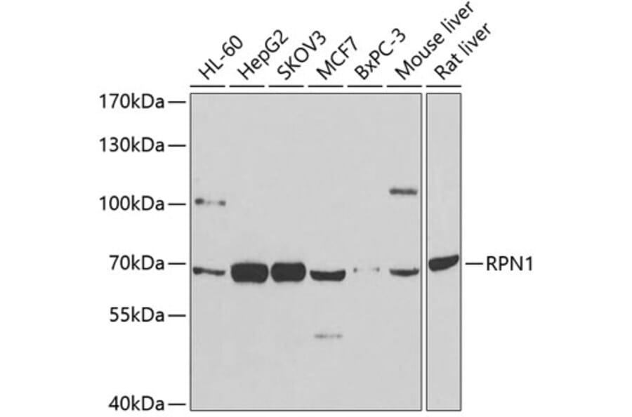 Western Blot - Anti-Ribophorin I Antibody (A90900) - Antibodies.com