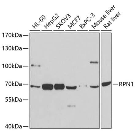 Western Blot - Anti-Ribophorin I Antibody (A90900) - Antibodies.com