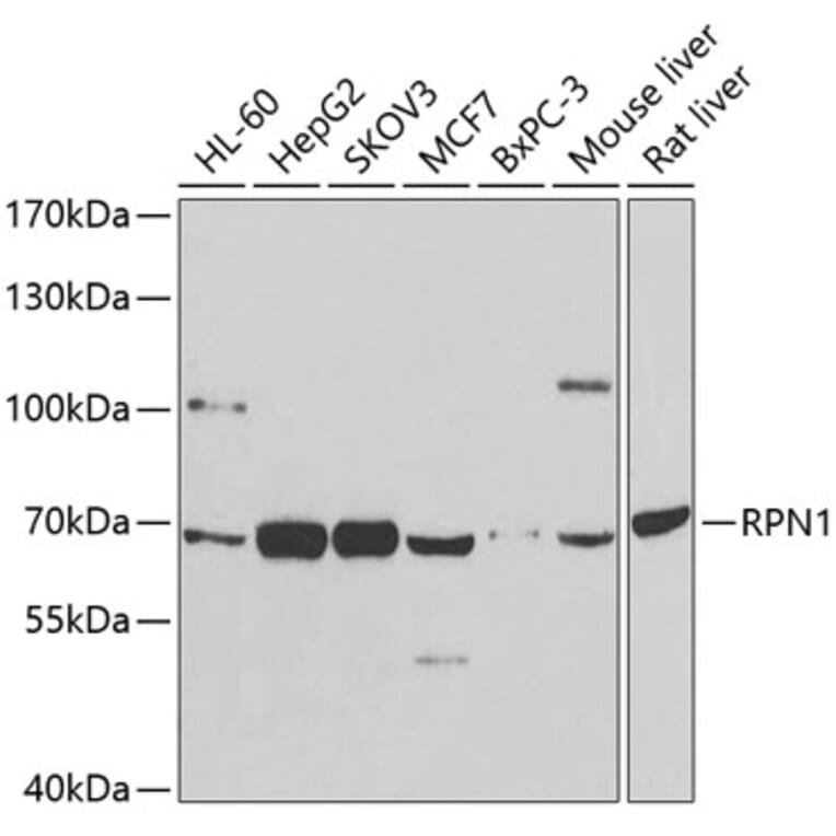 Western Blot - Anti-Ribophorin I Antibody (A90900) - Antibodies.com