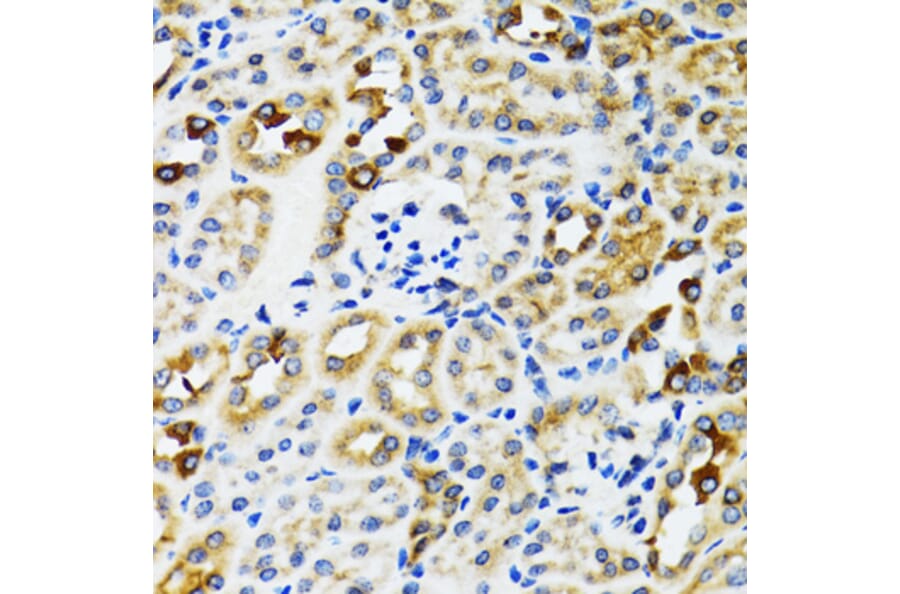 Immunohistochemistry - Anti-Ribophorin I Antibody (A90900) - Antibodies.com