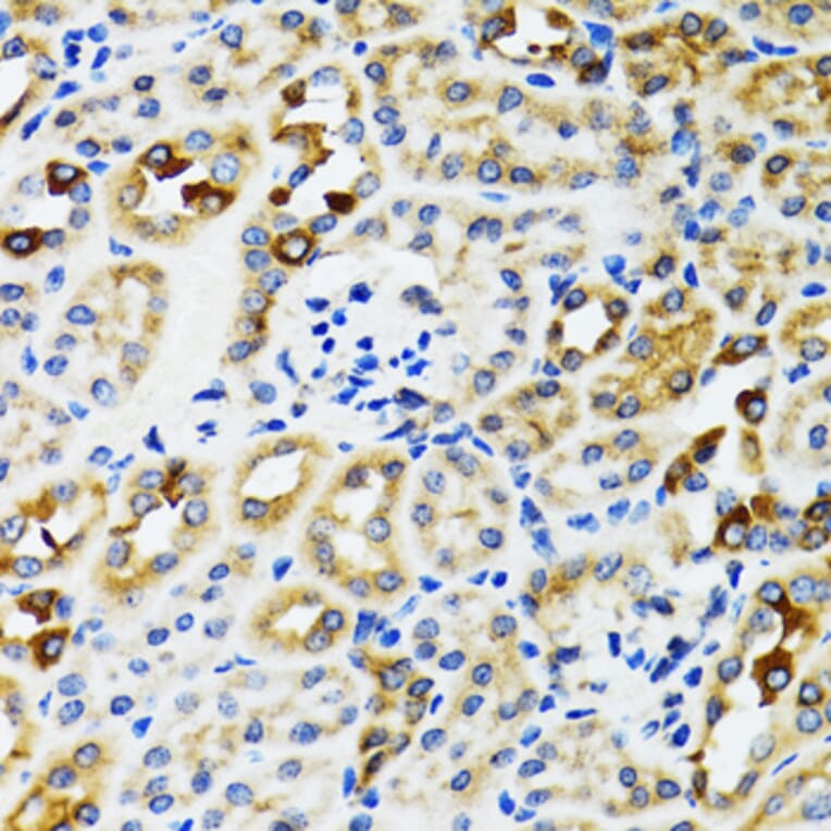 Immunohistochemistry - Anti-Ribophorin I Antibody (A90900) - Antibodies.com