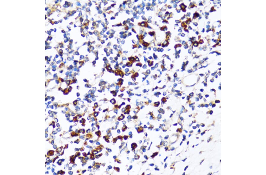 Immunohistochemistry - Anti-Ribophorin I Antibody (A90900) - Antibodies.com
