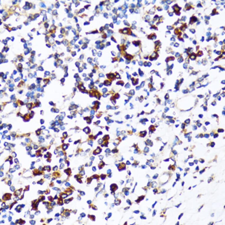 Immunohistochemistry - Anti-Ribophorin I Antibody (A90900) - Antibodies.com
