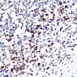 Immunohistochemistry - Anti-Ribophorin I Antibody (A90900) - Antibodies.com