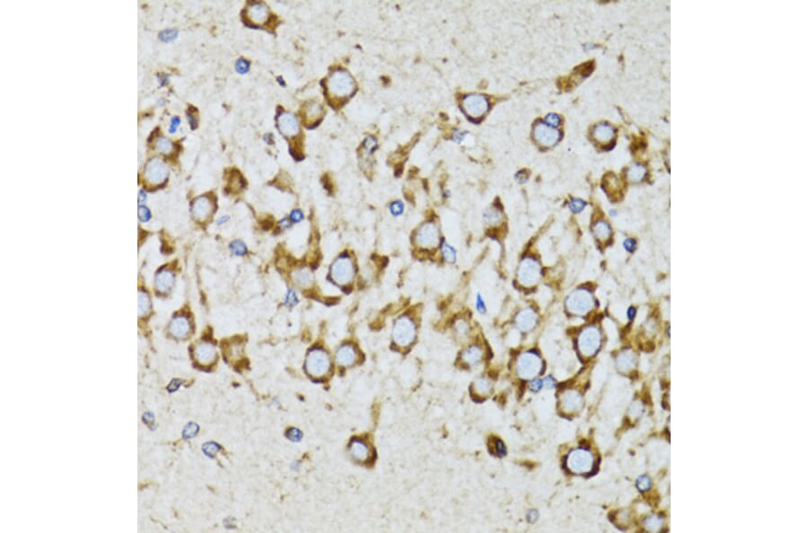 Immunohistochemistry - Anti-Ribophorin I Antibody (A90900) - Antibodies.com