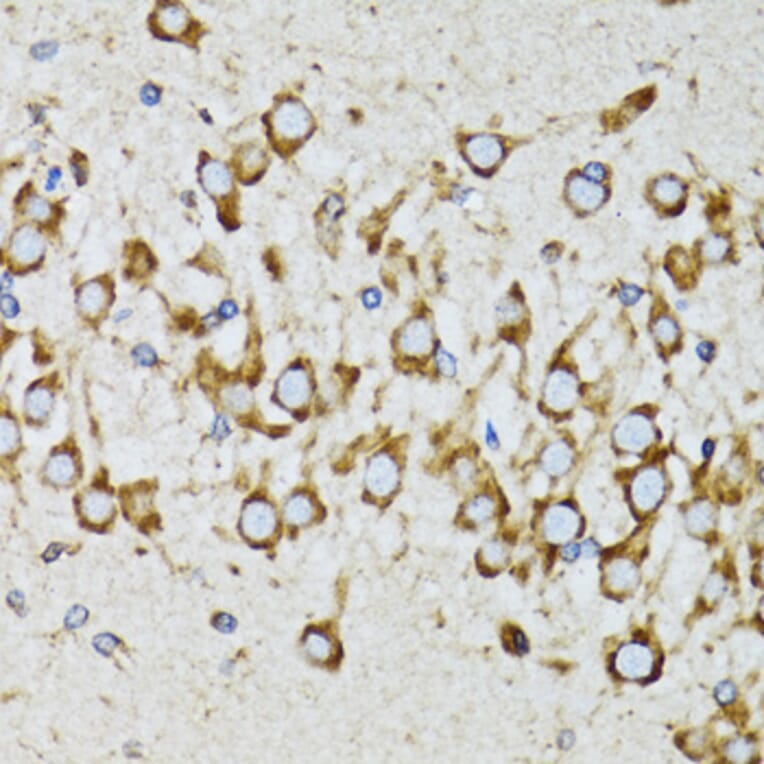 Immunohistochemistry - Anti-Ribophorin I Antibody (A90900) - Antibodies.com