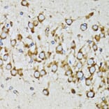 Immunohistochemistry - Anti-Ribophorin I Antibody (A90900) - Antibodies.com