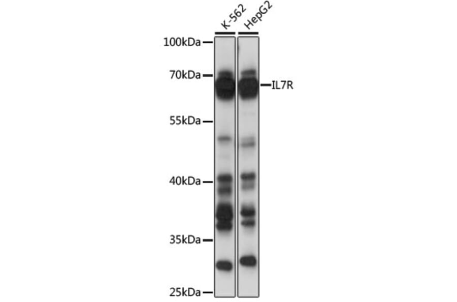 Western Blot - Anti-IL7R Antibody (A13502) - Antibodies.com