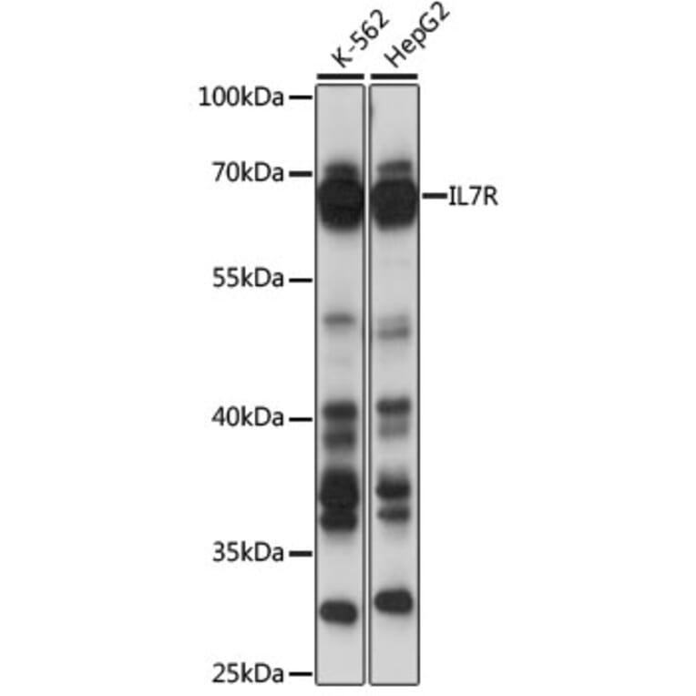 Western Blot - Anti-IL7R Antibody (A13502) - Antibodies.com