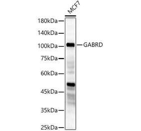 Western Blot - Anti-GABRD Antibody (A90903) - Antibodies.com