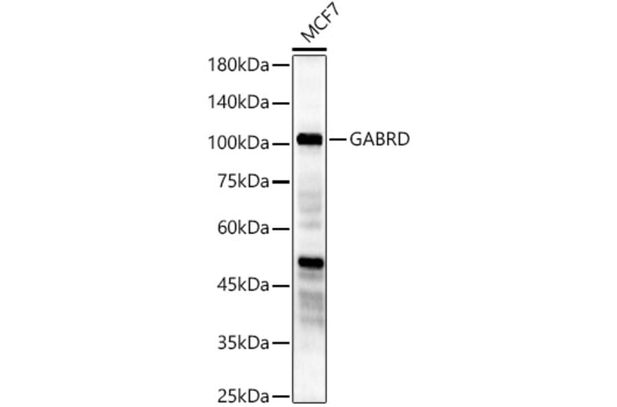 Western Blot - Anti-GABRD Antibody (A90903) - Antibodies.com