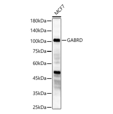Western Blot - Anti-GABRD Antibody (A90903) - Antibodies.com