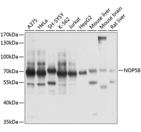 Western Blot - Anti-NOP58 Antibody (A90905) - Antibodies.com
