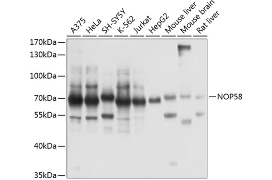 Western Blot - Anti-NOP58 Antibody (A90905) - Antibodies.com