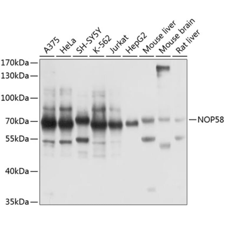 Western Blot - Anti-NOP58 Antibody (A90905) - Antibodies.com