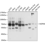 Western Blot - Anti-NOP58 Antibody (A90905) - Antibodies.com