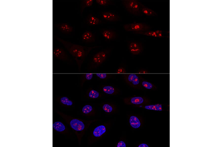 Immunofluorescence - Anti-NOP58 Antibody (A90905) - Antibodies.com