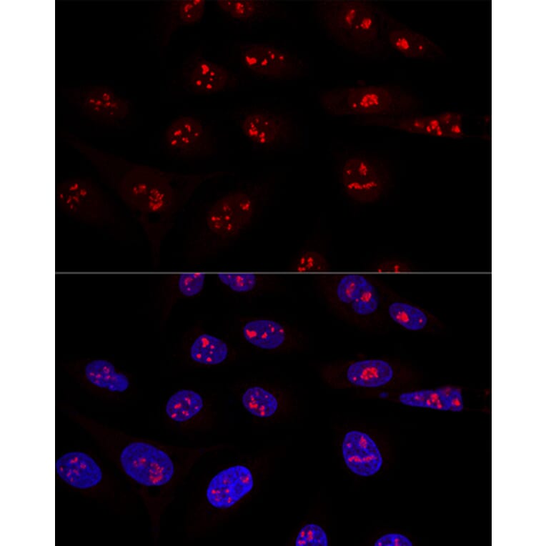 Immunofluorescence - Anti-NOP58 Antibody (A90905) - Antibodies.com
