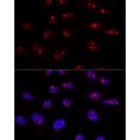 Immunofluorescence - Anti-NOP58 Antibody (A90905) - Antibodies.com