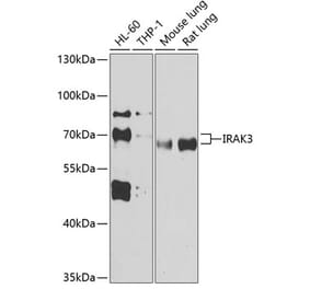 Western Blot - Anti-IRAKM Antibody (A90906) - Antibodies.com