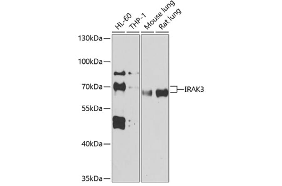 Western Blot - Anti-IRAKM Antibody (A90906) - Antibodies.com
