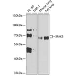 Western Blot - Anti-IRAKM Antibody (A90906) - Antibodies.com