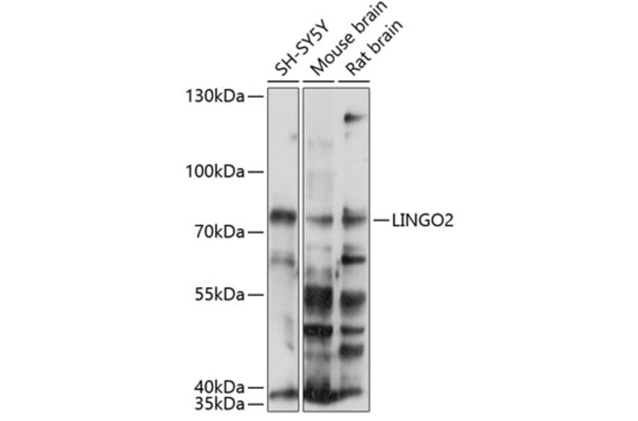 Western Blot - Anti-LINGO2 Antibody (A90907) - Antibodies.com