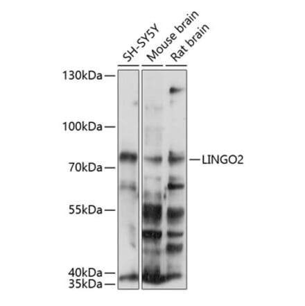 Western Blot - Anti-LINGO2 Antibody (A90907) - Antibodies.com