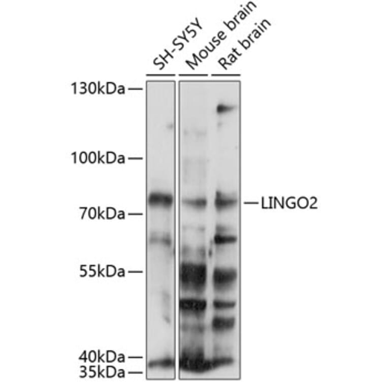 Western Blot - Anti-LINGO2 Antibody (A90907) - Antibodies.com