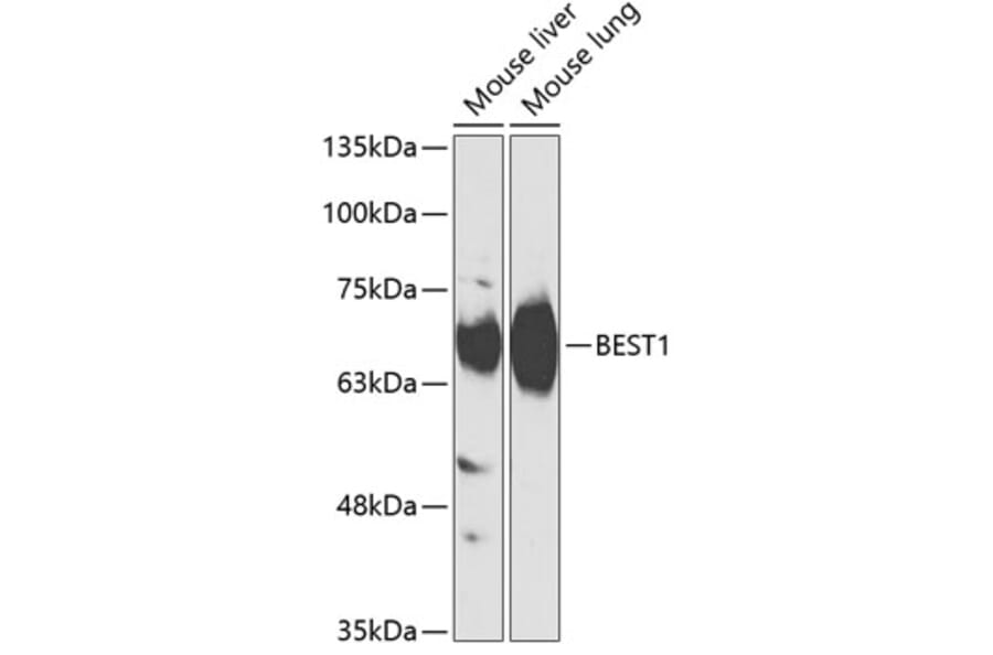 Western Blot - Anti-Bestrophin/BEST1 Antibody (A90908) - Antibodies.com