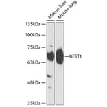 Western Blot - Anti-Bestrophin/BEST1 Antibody (A90908) - Antibodies.com