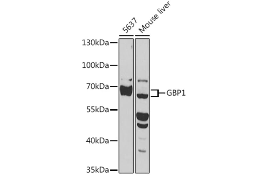 Western Blot - Anti-GBP1 Antibody (A90909) - Antibodies.com