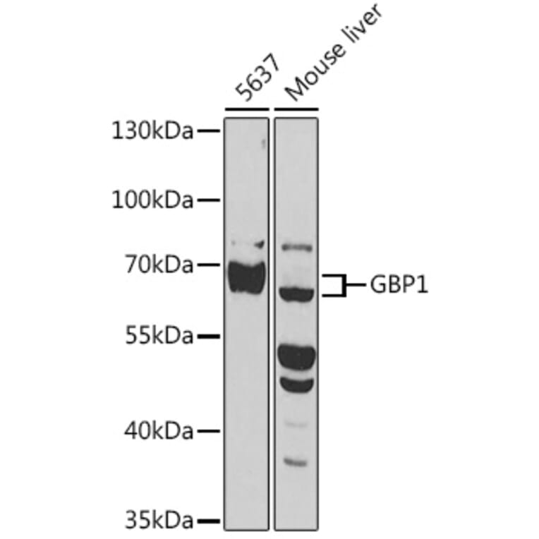 Western Blot - Anti-GBP1 Antibody (A90909) - Antibodies.com