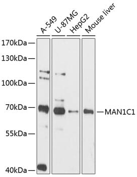 Western blot analysis of extracts of various cell lines, using Anti-MAN1C1 Antibody (A12837) at 1:3000 dilution.
Secondary antibody: Goat Anti-Rabbit IgG (H+L) (HRP) (AS014) at 1:10,000 dilution.
Lysates / proteins: 25µg per lane.
Blocking buffer: 3% non-fat dry milk in TBST.
Detection: ECL Basic Kit (RM00020).
Exposure time: 90s.