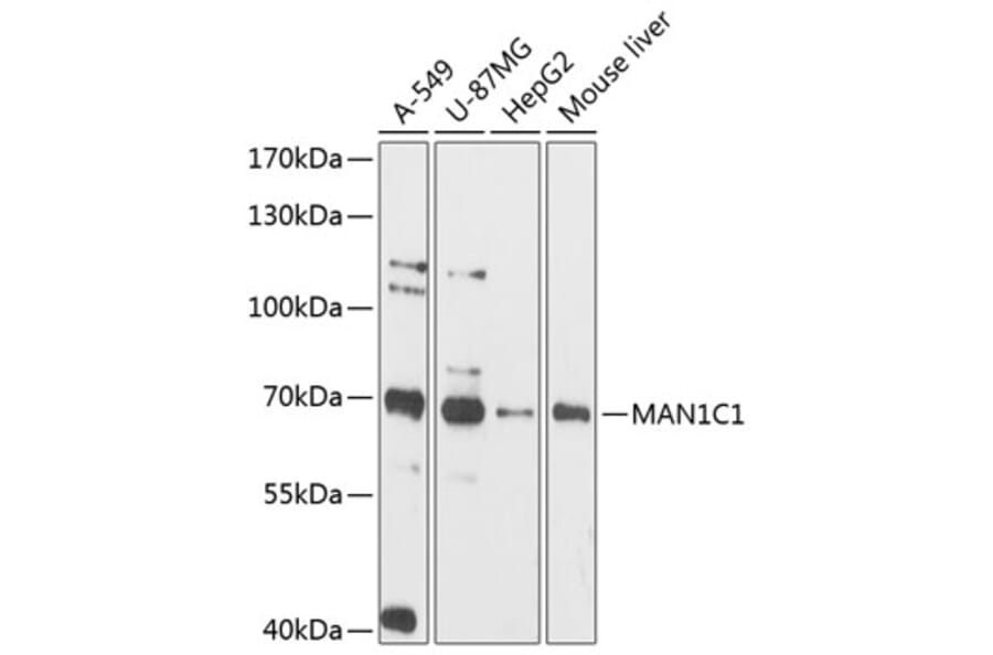 Western Blot - Anti-MAN1C1 Antibody (A90911) - Antibodies.com