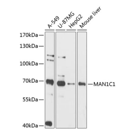 Western Blot - Anti-MAN1C1 Antibody (A90911) - Antibodies.com