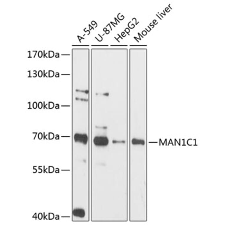 Western Blot - Anti-MAN1C1 Antibody (A90911) - Antibodies.com