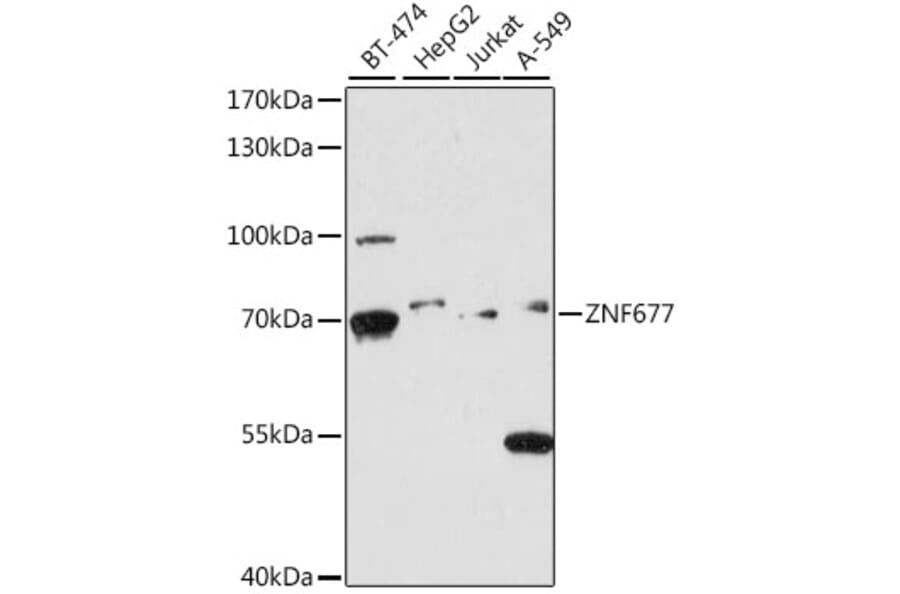 Western Blot - Anti-ZNF677 Antibody (A90912) - Antibodies.com