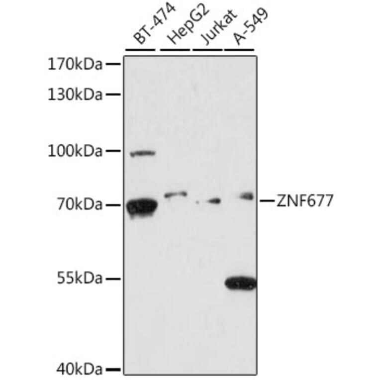 Western Blot - Anti-ZNF677 Antibody (A90912) - Antibodies.com
